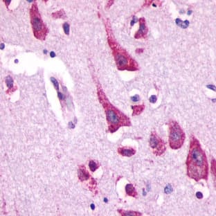 anti-Chemokine (C-X-C Motif) Receptor 4 (CXCR4) antibody avatar