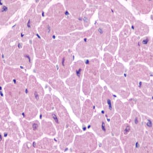 anti-Chemokine (C-X-C Motif) Receptor 4 (CXCR4) antibody avatar