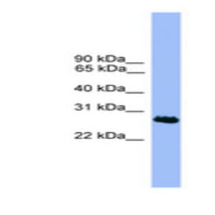 anti-Chromosome 1 Open Reading Frame 216 (C1ORF216) (N-Term) antibody avatar
