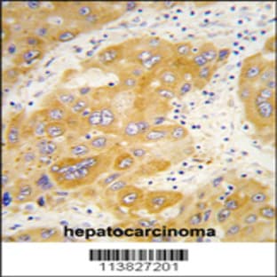 anti-Collagen, Type II, alpha 1 (COL2A1) (N-Term), (AA 469-497) antibody avatar