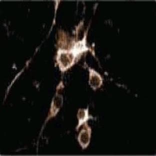 anti-Catechol-O-Methyltransferase (COMT) (AA 26-141) antibody avatar