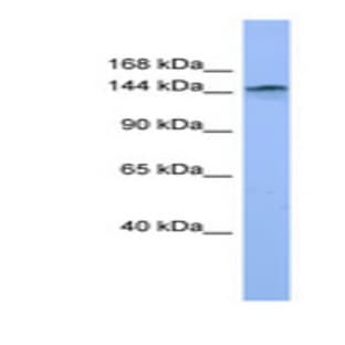 anti-Collagen, Type IV, alpha 3 (COL4a3) (Internal Region) antibody avatar