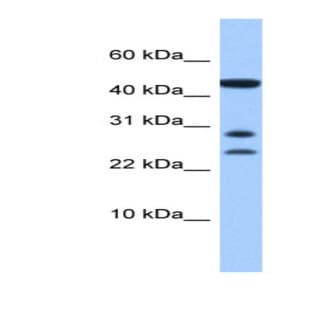 anti-Chromosome 20 Open Reading Frame 141 (C20orf141) (Middle Region) antibody avatar