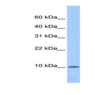 anti-Chromosome 20 Open Reading Frame 141 (C20orf141) (Middle Region) antibody avatar