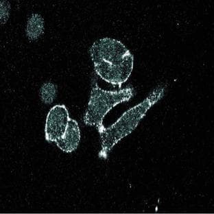 anti-Ceruloplasmin (Ferroxidase) (CP) (AA 233-355) antibody