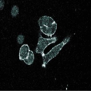 anti-Ceruloplasmin (Ferroxidase) (CP) (AA 233-355) antibody