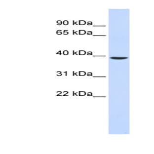 anti-Chromosome 2 Open Reading Frame 60 (C2orf60) (Middle Region) antibody avatar