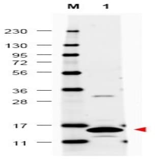 anti-Colony Stimulating Factor 2 (Granulocyte-Macrophage) (CSF2) antibody avatar