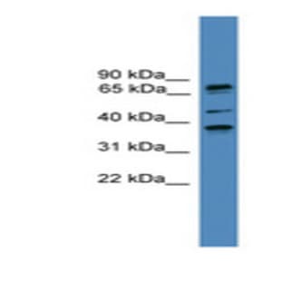 anti-Bardet-Biedl Syndrome 5 (BBS5) (N-Term) antibody
