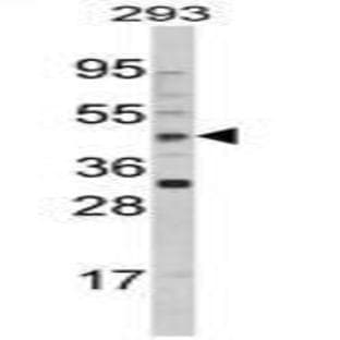 anti-Arylacetamide Deacetylase (Esterase) (AADAC) (C-Term) antibody avatar