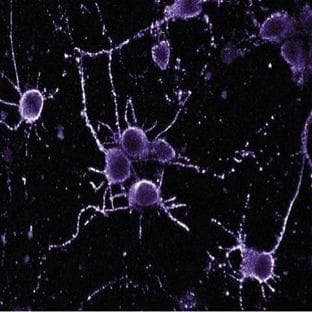 anti-Casein Kinase 2, beta (CSNK2B) (AA 21-215) antibody avatar