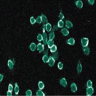 anti-Cytochrome B-245, beta Polypeptide (CYBB) (AA 450-556) antibody avatar