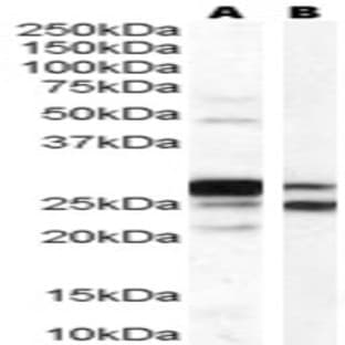 anti-Catechol-O-Methyltransferase (COMT) (Internal Region) antibody avatar
