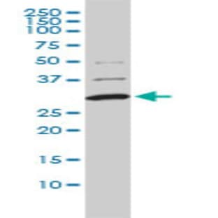 anti-Catechol-O-Methyltransferase (COMT) (AA 1-183) antibody avatar