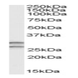 anti-Catechol-O-Methyltransferase (COMT) (N-Term) antibody avatar