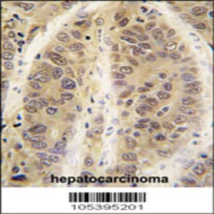 anti-Adenosine Kinase (ADK) (C-Term), (AA 322-352) antibody avatar