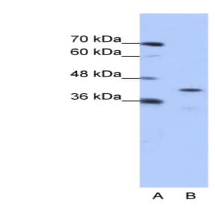 anti-Cytoplasmic Polyadenylation Element Binding Protein 2 (CPEB2) (Middle Region) antibody avatar
