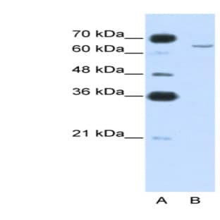 anti-Cytoplasmic Polyadenylation Element Binding Protein 2 (CPEB2) (N-Term) antibody avatar