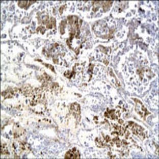 anti-Adrenomedullin (ADM) (N-Term) antibody avatar