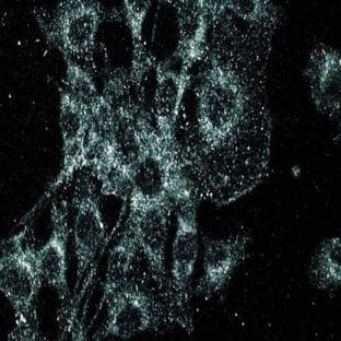 anti-Discs, Large Homolog 1 (Drosophila) (DLG1) (AA 5-213) antibody