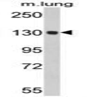anti-Ceruloplasmin (Ferroxidase) (CP) (Middle Region) antibody