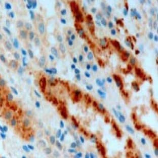 anti-Adenosine A2b Receptor (ADORA2B) (C-Term) antibody avatar