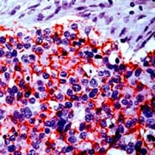 anti-Claudin 4 (CLDN4) (C-Term) antibody avatar