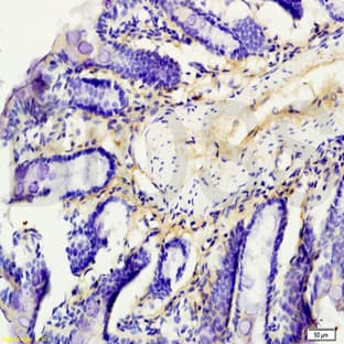 anti-Claudin 3 (CLDN3) antibody avatar