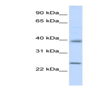 anti-Claudin 7 (CLDN7) (C-Term) antibody avatar