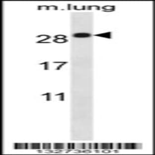 anti-Epithelial Membrane Protein 2 (EMP2) (C-Term), (AA 100-129) antibody avatar