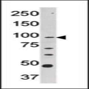 anti-Carnitine Palmitoyltransferase 1A (Liver) (CPT1A) (C-Term) antibody avatar