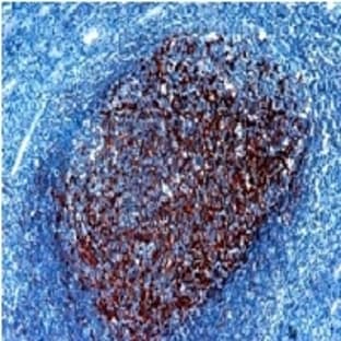 anti-Complement Component (3d/Epstein Barr Virus) Receptor 2 (CR2) antibody avatar