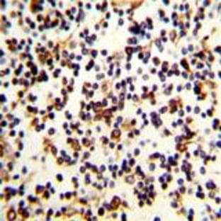 anti-Complement Component (3d/Epstein Barr Virus) Receptor 2 (CR2) (C-Term) antibody avatar