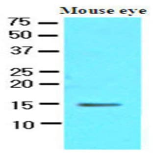 anti-Cellular Retinoic Acid Binding Protein 1 (CRABP1) (AA 1-137), (N-Term) antibody avatar