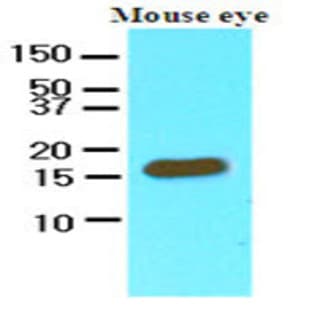 anti-Cellular Retinoic Acid Binding Protein 2 (CRABP2) (AA 1-138), (N-Term) antibody avatar
