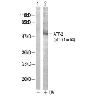 anti-Activating Transcription Factor 2 (ATF2) (pThr71), (pThr53) antibody avatar