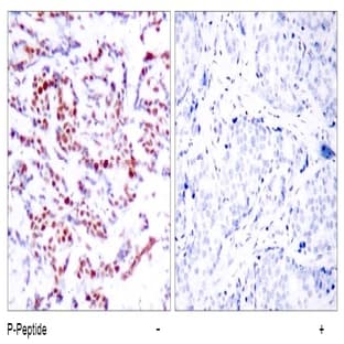 anti-Activating Transcription Factor 2 (ATF2) (pSer112), (pSer94) antibody avatar