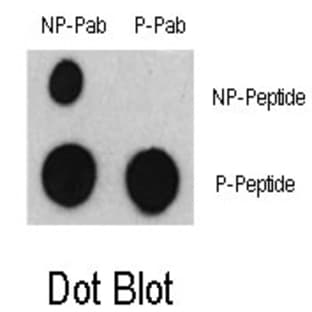 anti-Activating Transcription Factor 2 (ATF2) (pSer322) antibody avatar