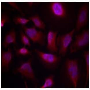 anti-Activating Transcription Factor 2 (ATF2) (pThr73), (pThr55) antibody avatar