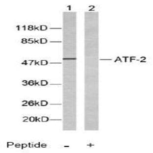 anti-Activating Transcription Factor 2 (ATF2) (Thr69), (Thr51) antibody avatar