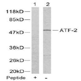 anti-Activating Transcription Factor 2 (ATF2) (Thr73), (Thr55) antibody avatar