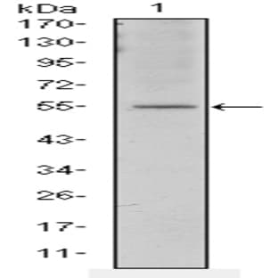 anti-Activating Transcription Factor 2 (ATF2) antibody avatar