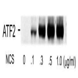anti-Activating Transcription Factor 2 (ATF2) (pSer490), (pSer498) antibody avatar