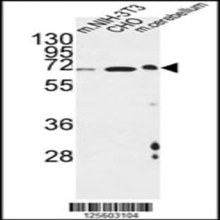 anti-Activating Transcription Factor 6 beta (ATF6B) (C-Term), (AA 560-589) antibody avatar