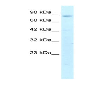 anti-Activating Transcription Factor 6 beta (ATF6B) (N-Term) antibody avatar