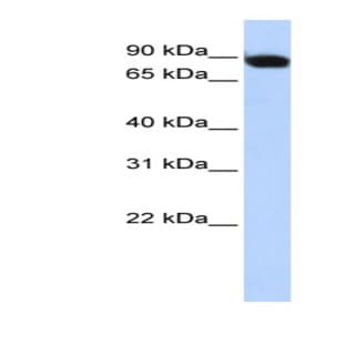 anti-Activating Transcription Factor 6 beta (ATF6B) (Middle Region) antibody avatar