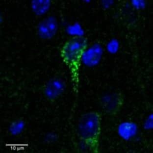anti-Corticotropin Releasing Hormone Receptor 1 (CRHR1) (Internal Region) antibody avatar