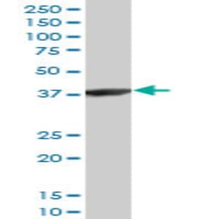 anti-Actin-Related Protein T2 (ACTRT2) (AA 209-300) antibody avatar