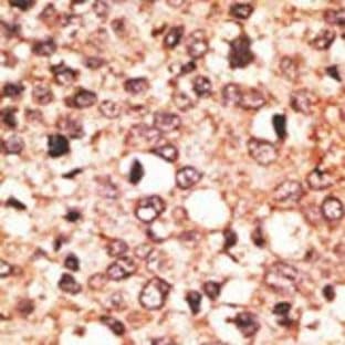 anti-Cryptochrome 1 (Photolyase-Like) (CRY1) (C-Term) antibody avatar