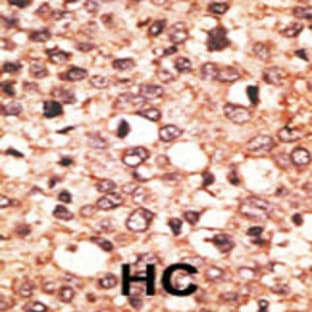 anti-Cryptochrome 1 (Photolyase-Like) (CRY1) (C-Term), (AA 556-586) antibody avatar